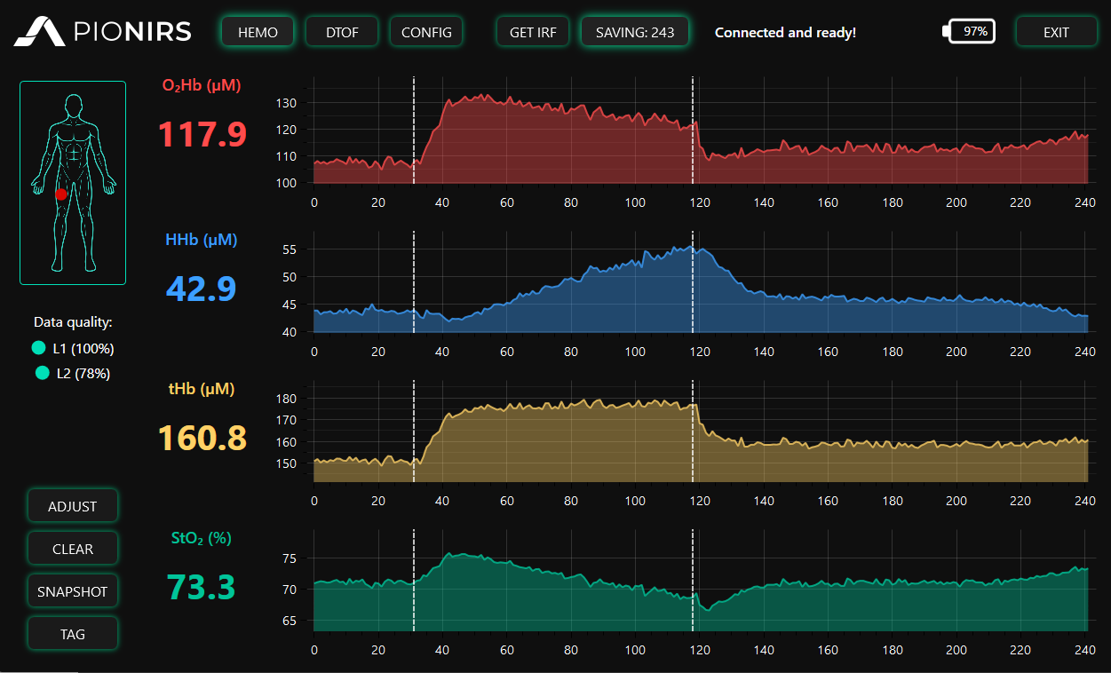Desktop app showing live O2Hb, HHb, tHb and StO2 traces for wearable TD-NIRS device